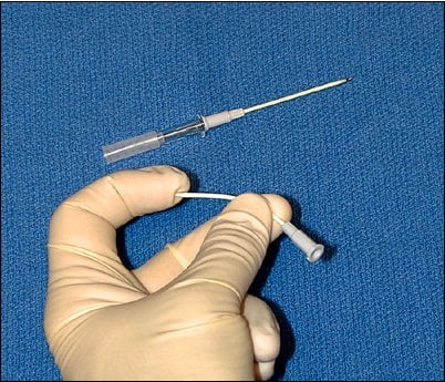 Intravenous catheter