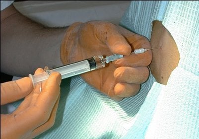 Spinal needle detail